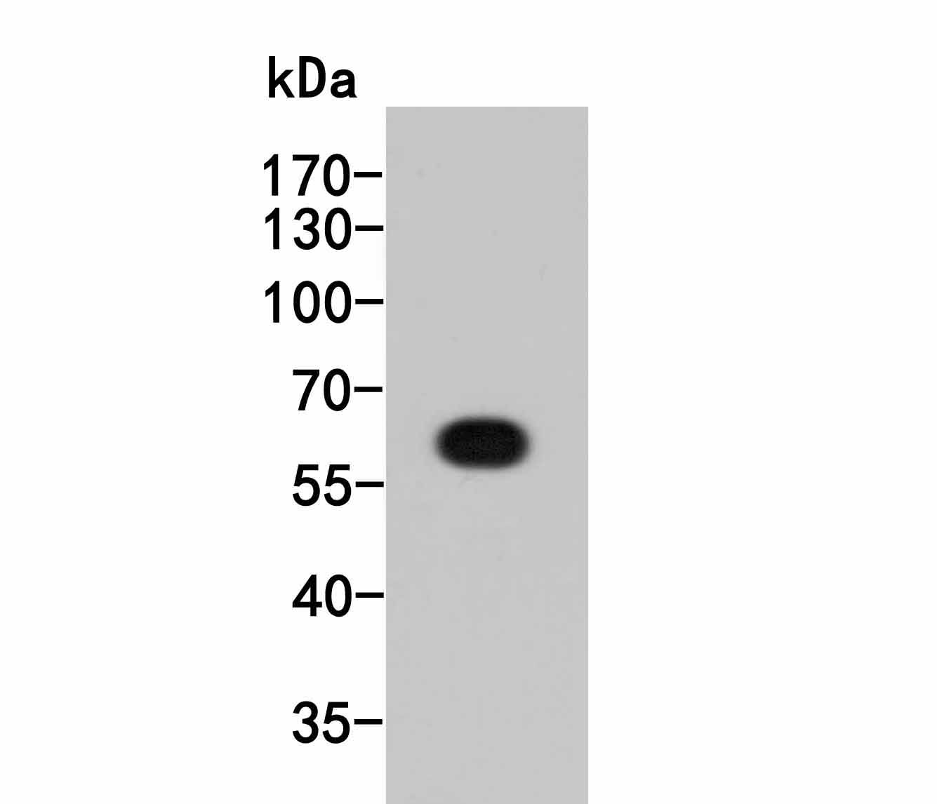Western blot analysis of HA tag on HA tag recombinant protein. Proteins were transferred to a PVDF membrane and blocked with 5% BSA in PBS for 1 hour at room temperature. The primary antibody (ET1611-49, 1/1,000) was used in 5% BSA at room temperature for 2 hours. Goat Anti-Rabbit IgG - HRP Secondary Antibody (HA1001) at 1:5,000 dilution was used for 1 hour at room temperature.