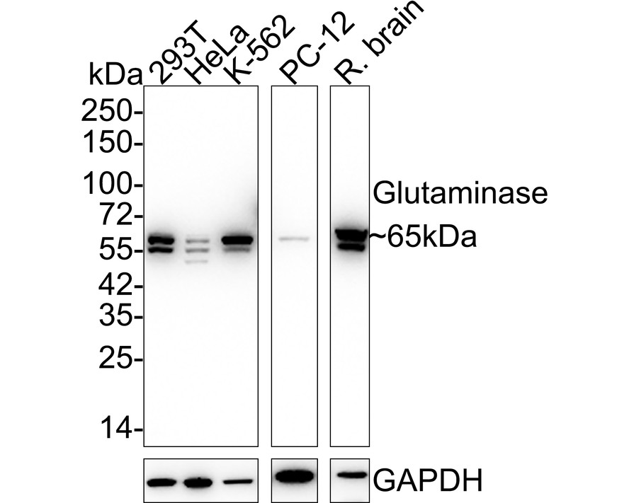 Western blot analysis of Glutaminase on different lysates. Proteins were transferred to a PVDF membrane and blocked with 5% BSA in PBS for 1 hour at room temperature. The primary antibody (ET1611-5, 1/500) was used in 5% BSA at room temperature for 2 hours. Goat Anti-Rabbit IgG - HRP Secondary Antibody (HA1001) at 1:40,000 dilution was used for 1 hour at room temperature.<br />
Positive control: <br />
Lane 1: Hela cell lysate<br />
Lane 2: 293 cell lysate