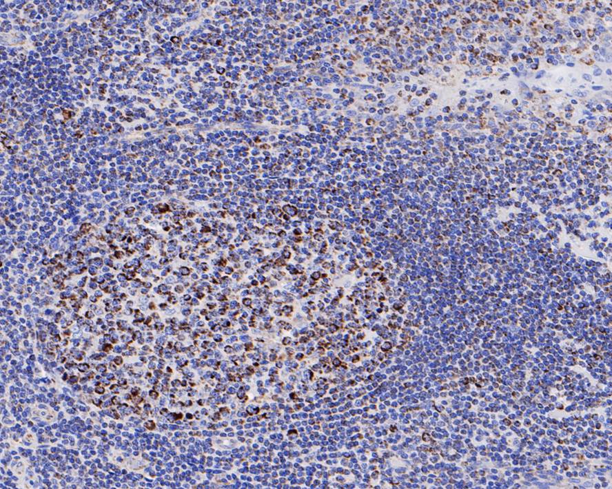 Immunohistochemical analysis of paraffin-embedded human tonsil tissue with Rabbit anti-Glutaminase antibody (ET1611-5) at 1/200 dilution.<br />
<br />
The section was pre-treated using heat mediated antigen retrieval with Tris-EDTA buffer (pH 9.0) for 20 minutes. The tissues were blocked in 1% BSA for 20 minutes at room temperature, washed with ddH2O and PBS, and then probed with the primary antibody (ET1611-5) at 1/200 dilution for 1 hour at room temperature. The detection was performed using an HRP conjugated compact polymer system. DAB was used as the chromogen. Tissues were counterstained with hematoxylin and mounted with DPX.