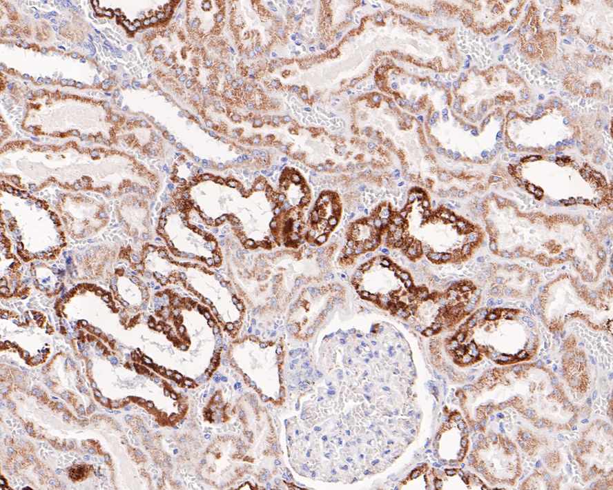 Immunohistochemical analysis of paraffin-embedded human kidney tissue with Rabbit anti-Glutaminase antibody (ET1611-5) at 1/200 dilution.<br />
<br />
The section was pre-treated using heat mediated antigen retrieval with Tris-EDTA buffer (pH 9.0) for 20 minutes. The tissues were blocked in 1% BSA for 20 minutes at room temperature, washed with ddH2O and PBS, and then probed with the primary antibody (ET1611-5) at 1/200 dilution for 1 hour at room temperature. The detection was performed using an HRP conjugated compact polymer system. DAB was used as the chromogen. Tissues were counterstained with hematoxylin and mounted with DPX.