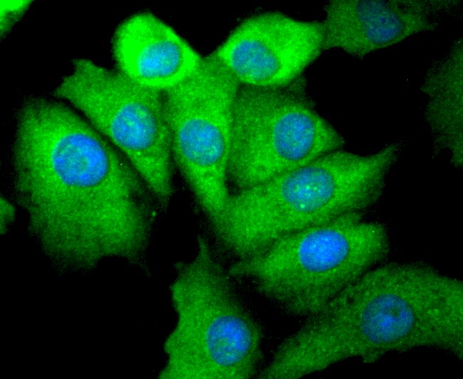 ICC staining Phospho-EGFR(S695) (1/50) in A549 cells (green). The nuclear counter stain is DAPI (blue). Cells were fixed in paraformaldehyde, permeabilised with 0.25% Triton X100/PBS.
