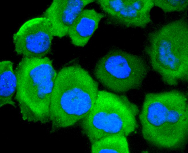 ICC staining Phospho-EGFR(S695)  (1/50) in HUVEC cells (green). The nuclear counter stain is DAPI (blue). Cells were fixed in paraformaldehyde, permeabilised with 0.25% Triton X100/PBS.