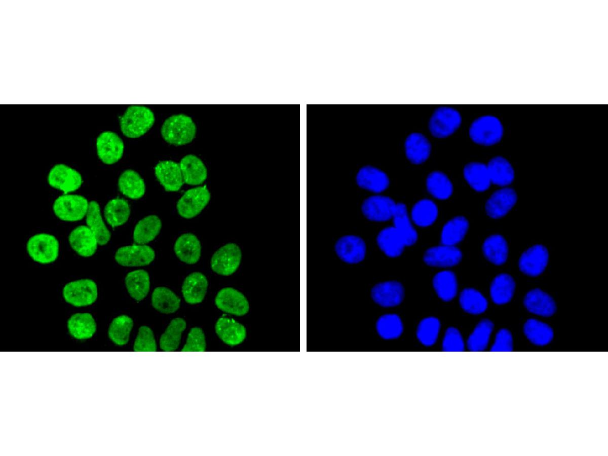 ICC staining of Histone H3(di methyl K9) in HepG2 cells (green). Formalin fixed cells were permeabilized with 0.1% Triton X-100 in TBS for 10 minutes at room temperature and blocked with 1% Blocker BSA for 15 minutes at room temperature. Cells were probed with the primary antibody (ET1611-51, 1/50) for 1 hour at room temperature, washed with PBS. Alexa Fluor®488 Goat anti-Rabbit IgG was used as the secondary antibody at 1/1,000 dilution. The nuclear counter stain is DAPI (blue).