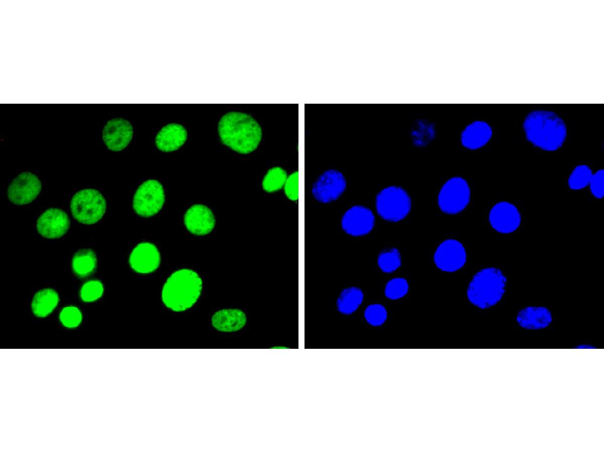 ICC staining of Histone H3(di methyl K9) in NIH/3T3 cells (green). Formalin fixed cells were permeabilized with 0.1% Triton X-100 in TBS for 10 minutes at room temperature and blocked with 1% Blocker BSA for 15 minutes at room temperature. Cells were probed with the primary antibody (ET1611-51, 1/50) for 1 hour at room temperature, washed with PBS. Alexa Fluor®488 Goat anti-Rabbit IgG was used as the secondary antibody at 1/1,000 dilution. The nuclear counter stain is DAPI (blue).