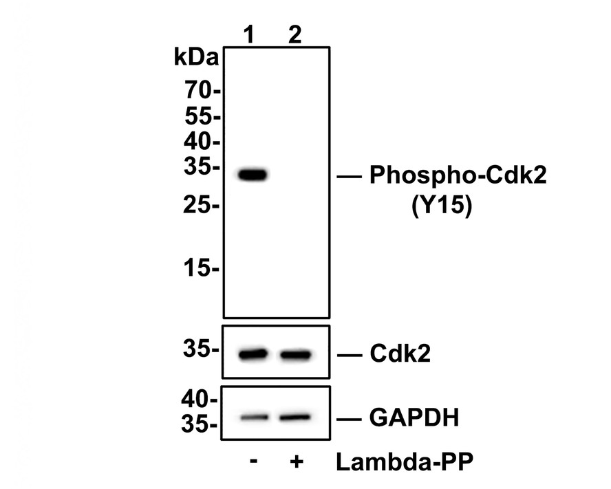 Western blot analysis of Phospho-Cdk2(Y15) on Hela cell lysates.<br />
<br />
Lane 1: Hela cells, whole cell lysate, 10ug/lane<br />
Lane 2: Hela cells treated with 2.8ug/ul lambda-PP for 30 minutes, whole cell lysates, 10ug/lane<br />
<br />
All lanes :<br />
Anti-Phospho-Cdk2(Y15) antibody (ET1611-52) at 1/500 dilution. Anti-Cdk2 antibody (ET1602-6) at 1/500 dilution. Anti-GAPDH antibody (ET1601-4) at 1/10,000 dilution. Goat Anti-Rabbit IgG H&L (HRP) (HA1001) at 1/200,000 dilution.<br />
<br />
Predicted band size: 34 kDa<br />
Observed band size: 34 kDa<br />
<br />
Blocking and diluting buffer: 5% BSA.<br />
<br />
Exposure time: 30 seconds