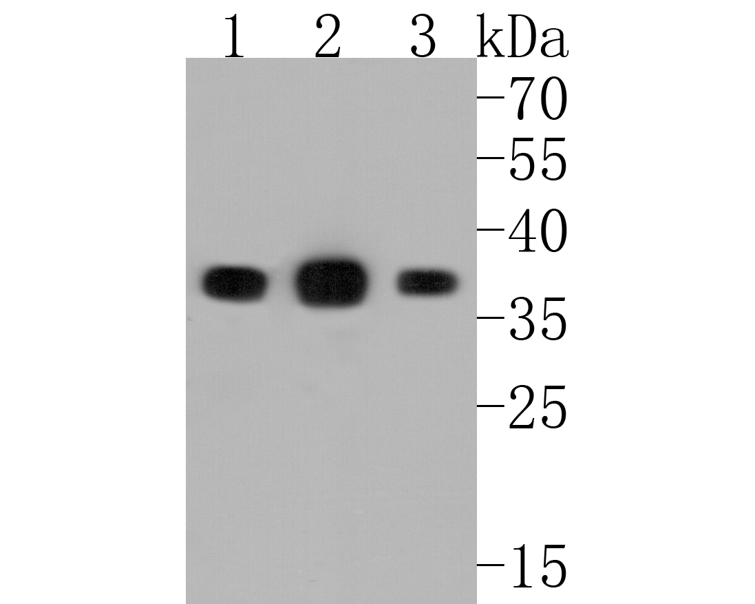 Western blot analysis of PP2A alpha + beta on different lysates. Proteins were transferred to a PVDF membrane and blocked with 5% BSA in PBS for 1 hour at room temperature. The primary antibody (ET1611-54, 1/500) was used in 5% BSA at room temperature for 2 hours. Goat Anti-Rabbit IgG - HRP Secondary Antibody (HA1001) at 1:5,000 dilution was used for 1 hour at room temperature.<br />
Positive control: <br />
Lane 1: A431 cell lysate<br />
Lane 2: 293T cell lysate<br />
Lane 3: NIH/3T3 cell lysate