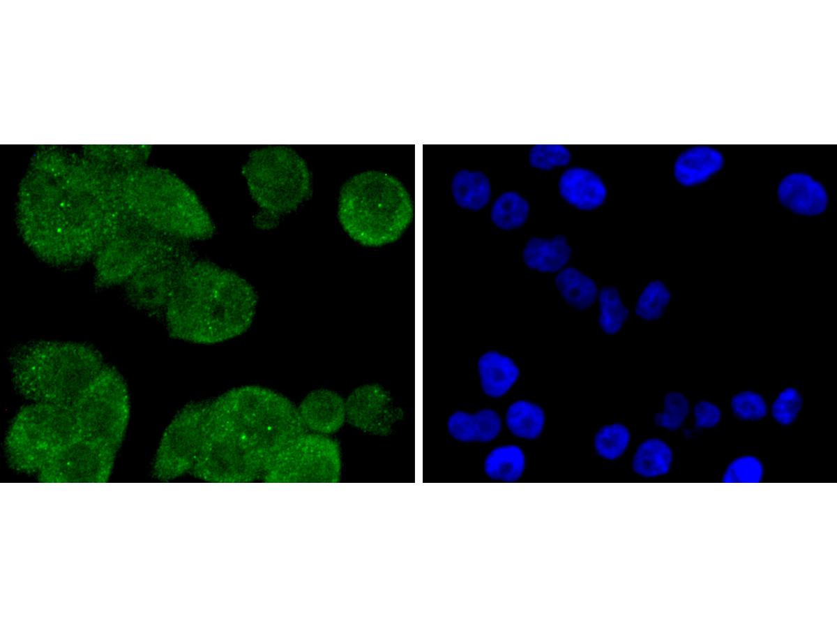 ICC staining of PP2A alpha + beta in PANC-1 cells (green). Formalin fixed cells were permeabilized with 0.1% Triton X-100 in TBS for 10 minutes at room temperature and blocked with 1% Blocker BSA for 15 minutes at room temperature. Cells were probed with the primary antibody (ET1611-54, 1/50) for 1 hour at room temperature, washed with PBS. Alexa Fluor®488 Goat anti-Rabbit IgG was used as the secondary antibody at 1/1,000 dilution. The nuclear counter stain is DAPI (blue).