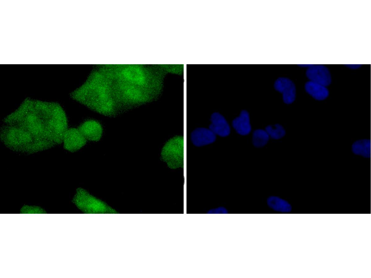 ICC staining of PP2A alpha + beta in Hela cells (green). Formalin fixed cells were permeabilized with 0.1% Triton X-100 in TBS for 10 minutes at room temperature and blocked with 1% Blocker BSA for 15 minutes at room temperature. Cells were probed with the primary antibody (ET1611-54, 1/50) for 1 hour at room temperature, washed with PBS. Alexa Fluor®488 Goat anti-Rabbit IgG was used as the secondary antibody at 1/1,000 dilution. The nuclear counter stain is DAPI (blue).