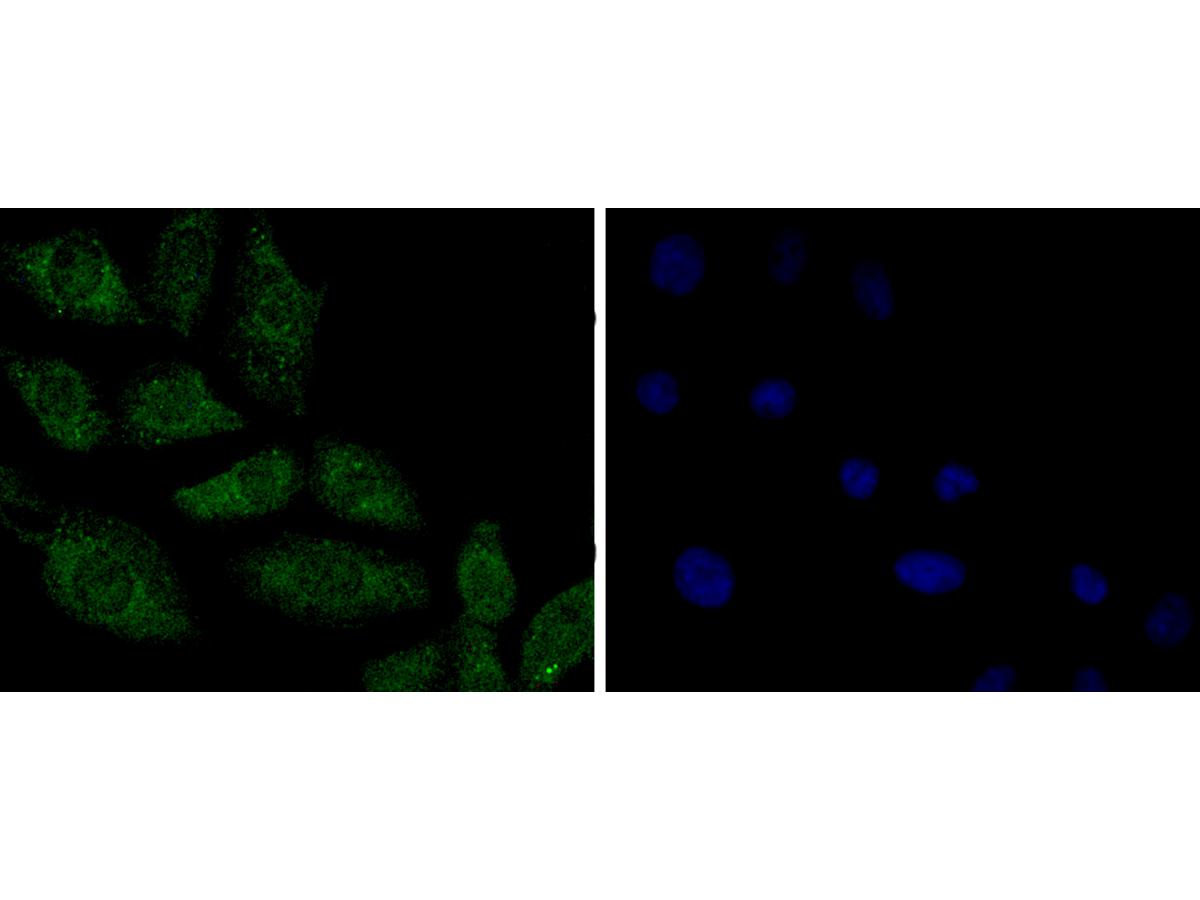 ICC staining of PP2A alpha + beta in L6 cells (green). Formalin fixed cells were permeabilized with 0.1% Triton X-100 in TBS for 10 minutes at room temperature and blocked with 1% Blocker BSA for 15 minutes at room temperature. Cells were probed with the primary antibody (ET1611-54, 1/50) for 1 hour at room temperature, washed with PBS. Alexa Fluor®488 Goat anti-Rabbit IgG was used as the secondary antibody at 1/1,000 dilution. The nuclear counter stain is DAPI (blue).