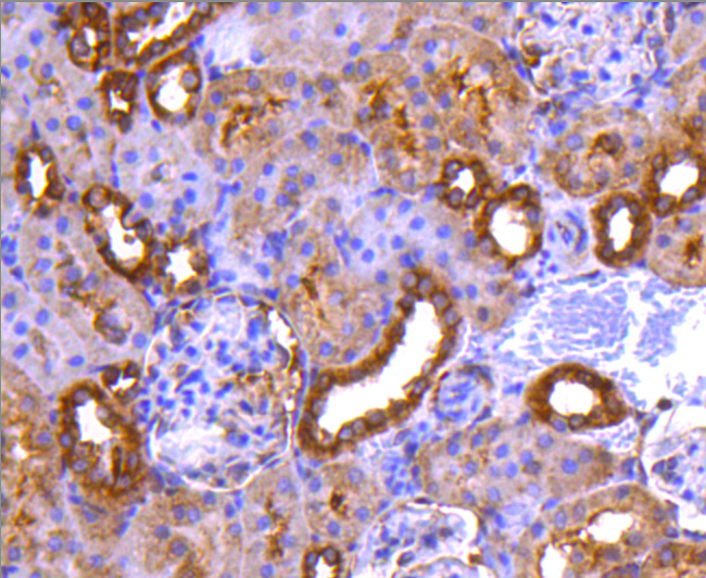 Immunohistochemical analysis of paraffin-embedded rat kidney tissue using anti-PP2A alpha + beta antibody. The section was pre-treated using heat mediated antigen retrieval with Tris-EDTA buffer (pH 8.0-8.4) for 20 minutes.The tissues were blocked in 5% BSA for 30 minutes at room temperature, washed with ddH2O and PBS, and then probed with the primary antibody (ET1611-54, 1/50) for 30 minutes at room temperature. The detection was performed using an HRP conjugated compact polymer system. DAB was used as the chromogen. Tissues were counterstained with hematoxylin and mounted with DPX.
