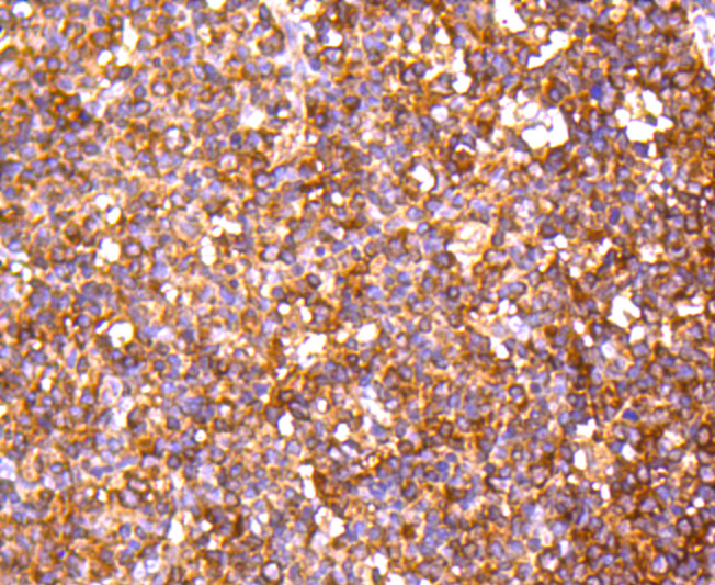Immunohistochemical analysis of paraffin-embedded human tonsil tissue using anti-PP2A alpha + beta antibody. The section was pre-treated using heat mediated antigen retrieval with Tris-EDTA buffer (pH 8.0-8.4) for 20 minutes.The tissues were blocked in 5% BSA for 30 minutes at room temperature, washed with ddH2O and PBS, and then probed with the primary antibody (ET1611-54, 1/50) for 30 minutes at room temperature. The detection was performed using an HRP conjugated compact polymer system. DAB was used as the chromogen. Tissues were counterstained with hematoxylin and mounted with DPX.