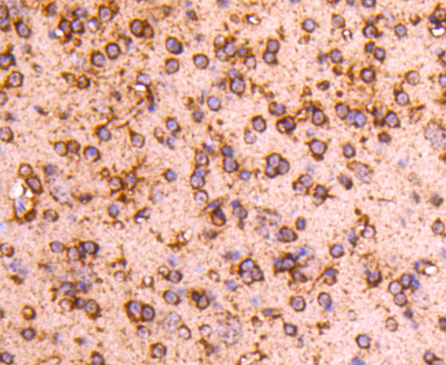 Immunohistochemical analysis of paraffin-embedded mouse brain tissue using anti-PP2A alpha + beta antibody. The section was pre-treated using heat mediated antigen retrieval with Tris-EDTA buffer (pH 8.0-8.4) for 20 minutes.The tissues were blocked in 5% BSA for 30 minutes at room temperature, washed with ddH2O and PBS, and then probed with the primary antibody (ET1611-54, 1/50) for 30 minutes at room temperature. The detection was performed using an HRP conjugated compact polymer system. DAB was used as the chromogen. Tissues were counterstained with hematoxylin and mounted with DPX.
