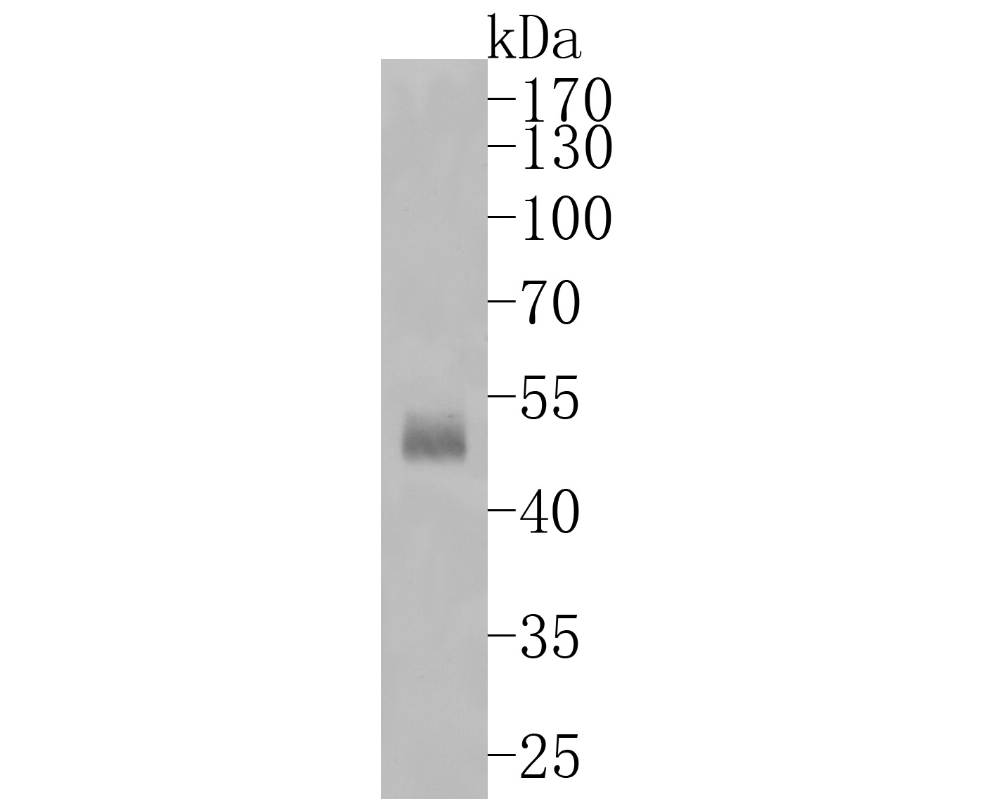 Western blot analysis of Cytokeratin 13 on human lung tissue lysates. Proteins were transferred to a PVDF membrane and blocked with 5% BSA in PBS for 1 hour at room temperature. The primary antibody (ET1611-55, 1/500) was used in 5% BSA at room temperature for 2 hours. Goat Anti-Rabbit IgG - HRP Secondary Antibody (HA1001) at 1:200,000 dilution was used for 1 hour at room temperature.