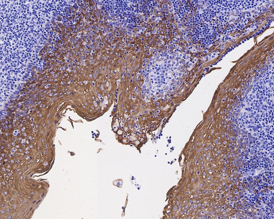 Immunohistochemical analysis of paraffin-embedded human tonsil tissue using anti-Cytokeratin 13 antibody. The section was pre-treated using heat mediated antigen retrieval with Tris-EDTA buffer (pH 9.0) for 20 minutes.The tissues were blocked in 5% BSA for 30 minutes at room temperature, washed with ddH2O and PBS, and then probed with the primary antibody (ET1611-55, 1/50) for 30 minutes at room temperature. The detection was performed using an HRP conjugated compact polymer system. DAB was used as the chromogen. Tissues were counterstained with hematoxylin and mounted with DPX.
