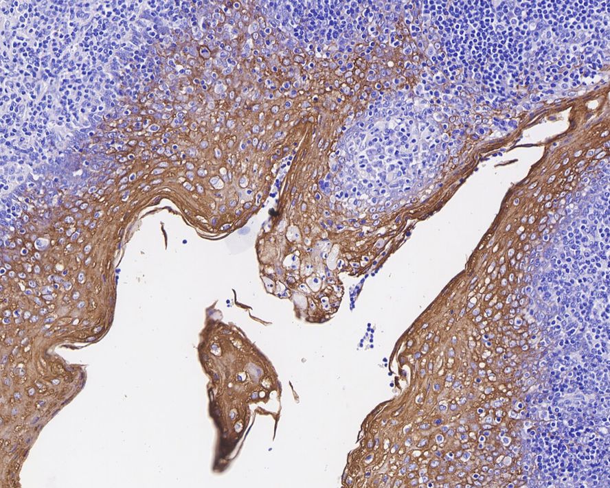 Immunohistochemical analysis of paraffin-embedded human tonsil tissue using anti-Cytokeratin 13 antibody. The section was pre-treated using heat mediated antigen retrieval with Tris-EDTA buffer (pH 9.0) for 20 minutes.The tissues were blocked in 5% BSA for 30 minutes at room temperature, washed with ddH2O and PBS, and then probed with the primary antibody (ET1611-55, 1/50) for 30 minutes at room temperature. The detection was performed using an HRP conjugated compact polymer system. DAB was used as the chromogen. Tissues were counterstained with hematoxylin and mounted with DPX.