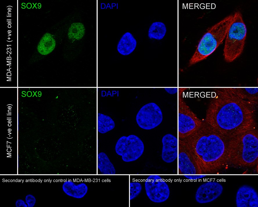 ICC staining of SOX9 in SW480 cells (green). Formalin fixed cells were permeabilized with 0.1% Triton X-100 in TBS for 10 minutes at room temperature and blocked with 10% negative goat serum for 15 minutes at room temperature. Cells were probed with the primary antibody (ET1611-56, 1/50) for 1 hour at room temperature, washed with PBS. Alexa Fluor®488 conjugate-Goat anti-Rabbit IgG was used as the secondary antibody at 1/1,000 dilution. The nuclear counter stain is DAPI (blue).