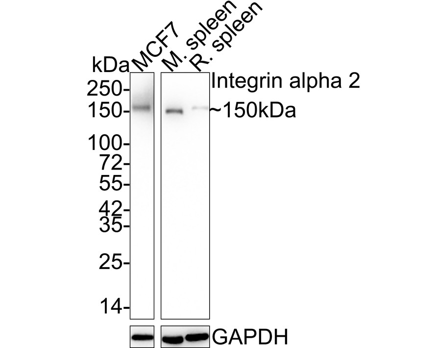 Western blot analysis of Integrin alpha 2 on different lysates. Proteins were transferred to a PVDF membrane and blocked with 5% BSA in PBS for 1 hour at room temperature. The primary antibody (ET1611-57, 1/500) was used in 5% BSA at room temperature for 2 hours. Goat Anti-Rabbit IgG - HRP Secondary Antibody (HA1001) at 1:5,000 dilution was used for 1 hour at room temperature.<br />
Positive control: <br />
Lane 1: MCF-7 cell lysate<br />
Lane 2: A431 cell lysate