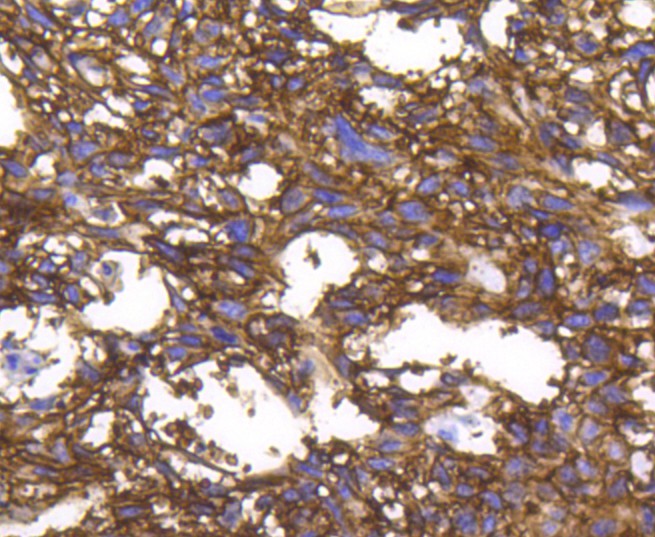 Immunohistochemical analysis of paraffin-embedded human kidney tissue using anti-Integrin alpha 2 antibody. The section was pre-treated using heat mediated antigen retrieval with Tris-EDTA buffer (pH 8.0-8.4) for 20 minutes.The tissues were blocked in 5% BSA for 30 minutes at room temperature, washed with ddH2O and PBS, and then probed with the primary antibody (ET1611-57, 1/50) for 30 minutes at room temperature. The detection was performed using an HRP conjugated compact polymer system. DAB was used as the chromogen. Tissues were counterstained with hematoxylin and mounted with DPX.