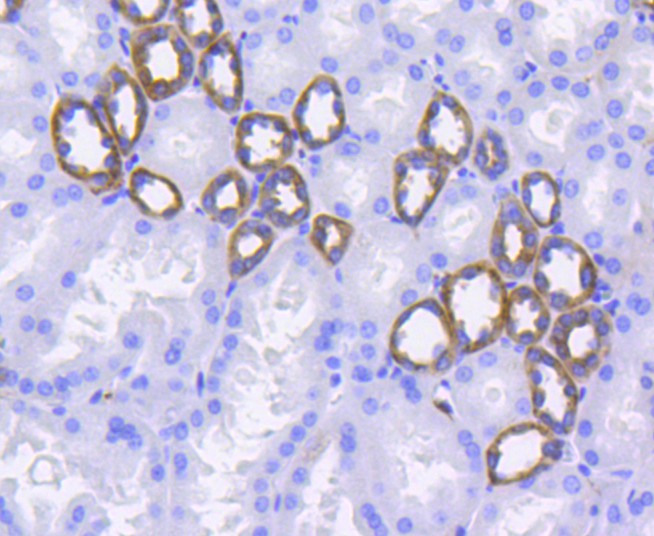 Immunohistochemical analysis of paraffin-embedded mouse colon tissue using anti-Integrin alpha 2 antibody. The section was pre-treated using heat mediated antigen retrieval with Tris-EDTA buffer (pH 8.0-8.4) for 20 minutes.The tissues were blocked in 5% BSA for 30 minutes at room temperature, washed with ddH2O and PBS, and then probed with the primary antibody (ET1611-57, 1/50) for 30 minutes at room temperature. The detection was performed using an HRP conjugated compact polymer system. DAB was used as the chromogen. Tissues were counterstained with hematoxylin and mounted with DPX.