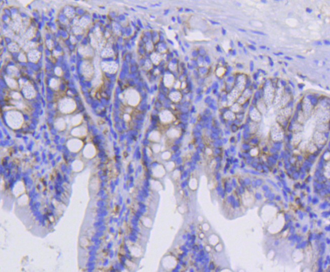 Immunohistochemical analysis of paraffin-embedded mouse stomach tissue using anti-Integrin alpha 2 antibody. The section was pre-treated using heat mediated antigen retrieval with Tris-EDTA buffer (pH 8.0-8.4) for 20 minutes.The tissues were blocked in 5% BSA for 30 minutes at room temperature, washed with ddH2O and PBS, and then probed with the primary antibody (ET1611-57, 1/50) for 30 minutes at room temperature. The detection was performed using an HRP conjugated compact polymer system. DAB was used as the chromogen. Tissues were counterstained with hematoxylin and mounted with DPX.
