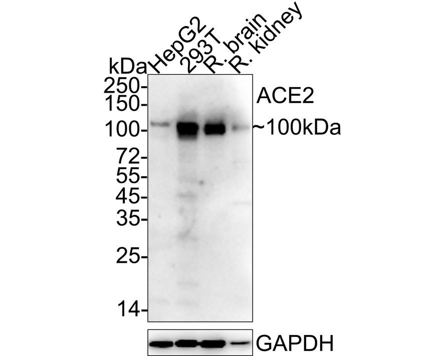Western blot analysis of ACE2 on different lysates with Rabbit anti-ACE2 antibody (ET1611-58) at 1/2,000 dilution.<br />
<br />
Lane 1: Human kidney tissue lysate<br />
Lane 2: Human small intestine tissue lysate<br />
<br />
Lysates/proteins at 20 µg/Lane.<br />
<br />
Predicted band size: 92 kDa<br />
Observed band size: 100 kDa<br />
<br />
Exposure time: 2 minutes;<br />
<br />
6% SDS-PAGE gel.<br />
<br />
Proteins were transferred to a PVDF membrane and blocked with 5% NFDM/TBST for 1 hour at room temperature. The primary antibody (ET1611-58) at 1/2,000 dilution was used in 5% NFDM/TBST at room temperature for 2 hours. Goat Anti-Rabbit IgG - HRP Secondary Antibody (HA1001) at 1:300,000 dilution was used for 1 hour at room temperature.