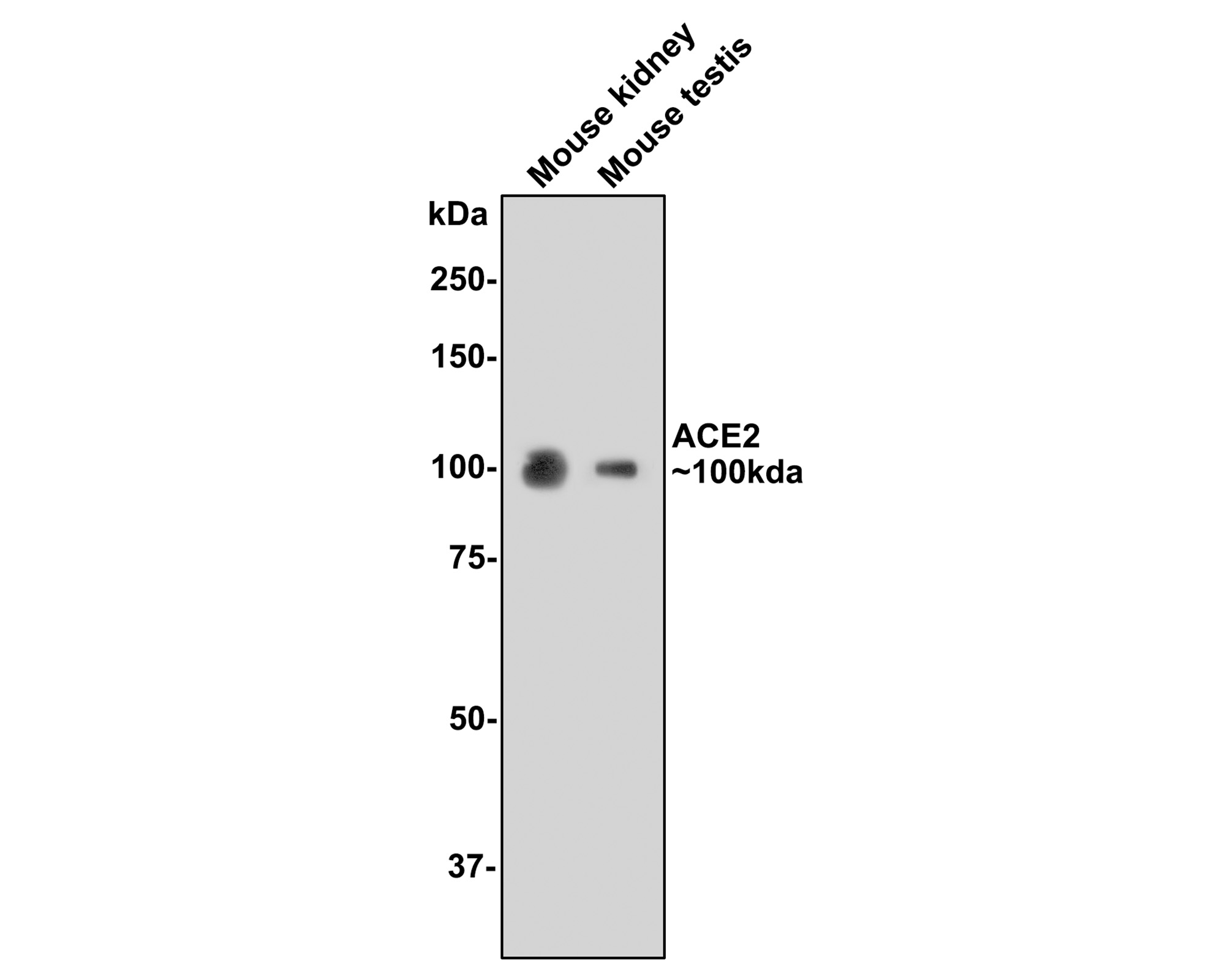 Western blot analysis of ACE2 on different lysates with Rabbit anti-ACE2 antibody (ET1611-58) at 1/1,000 dilution.<br />
<br />
Lane 1: Mouse kidney tissue lysate<br />
Lane 2: Mouse testis tissue lysate <br />
<br />
Lysates/proteins at 20 µg/Lane.<br />
<br />
Predicted band size: 92 kDa<br />
Observed band size: 100 kDa<br />
<br />
Exposure time: 2 minutes;<br />
<br />
8% SDS-PAGE gel.<br />
<br />
Proteins were transferred to a PVDF membrane and blocked with 5% NFDM/TBST for 1 hour at room temperature. The primary antibody (ET1611-58) at 1/1,000 dilution was used in 5% NFDM/TBST at room temperature for 2 hours. Goat Anti-Rabbit IgG - HRP Secondary Antibody (HA1001) at 1:200,000 dilution was used for 1 hour at room temperature.