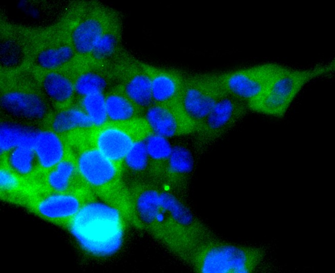 ICC staining of ACE2 in MCF-7 cells (green). Formalin fixed cells were permeabilized with 0.1% Triton X-100 in TBS for 10 minutes at room temperature and blocked with 1% Blocker BSA for 15 minutes at room temperature. Cells were probed with the primary antibody (ET1611-58, 1/50) for 1 hour at room temperature, washed with PBS. Alexa Fluor®488 Goat anti-Rabbit IgG was used as the secondary antibody at 1/1,000 dilution. The nuclear counter stain is DAPI (blue).