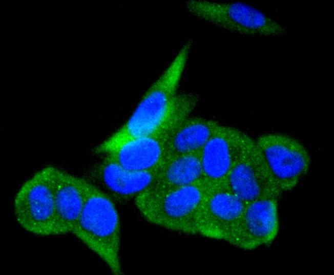 ICC staining of ACE2 in HepG2 cells (green). Formalin fixed cells were permeabilized with 0.1% Triton X-100 in TBS for 10 minutes at room temperature and blocked with 1% Blocker BSA for 15 minutes at room temperature. Cells were probed with the primary antibody (ET1611-58, 1/50) for 1 hour at room temperature, washed with PBS. Alexa Fluor®488 Goat anti-Rabbit IgG was used as the secondary antibody at 1/1,000 dilution. The nuclear counter stain is DAPI (blue).