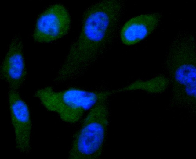 ICC staining of Glycogen synthase in PC-3M cells (green). Formalin fixed cells were permeabilized with 0.1% Triton X-100 in TBS for 10 minutes at room temperature and blocked with 1% Blocker BSA for 15 minutes at room temperature. Cells were probed with the primary antibody (ET1611-59, 1/50) for 1 hour at room temperature, washed with PBS. Alexa Fluor®488 Goat anti-Rabbit IgG was used as the secondary antibody at 1/1,000 dilution. The nuclear counter stain is DAPI (blue).