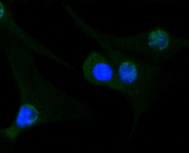 ICC staining of Glycogen synthase in NIH/3T3 cells (green). Formalin fixed cells were permeabilized with 0.1% Triton X-100 in TBS for 10 minutes at room temperature and blocked with 1% Blocker BSA for 15 minutes at room temperature. Cells were probed with the primary antibody (ET1611-59, 1/50) for 1 hour at room temperature, washed with PBS. Alexa Fluor®488 Goat anti-Rabbit IgG was used as the secondary antibody at 1/1,000 dilution. The nuclear counter stain is DAPI (blue).