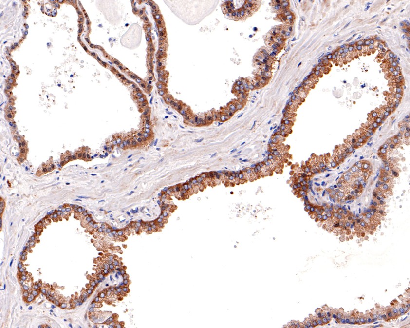Immunohistochemical analysis of paraffin-embedded human prostate tissue using anti-Glycogen synthase antibody. The section was pre-treated using heat mediated antigen retrieval with Tris-EDTA buffer (pH 8.0-8.4) for 20 minutes.The tissues were blocked in 5% BSA for 30 minutes at room temperature, washed with ddH2O and PBS, and then probed with the primary antibody (ET1611-59, 1/100) for 30 minutes at room temperature. The detection was performed using an HRP conjugated compact polymer system. DAB was used as the chromogen. Tissues were counterstained with hematoxylin and mounted with DPX.