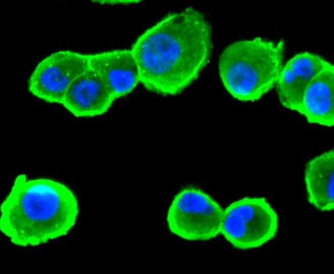 ICC staining of CD13 in PANC-1 cells (green). Formalin fixed cells were permeabilized with 0.1% Triton X-100 in TBS for 10 minutes at room temperature and blocked with 1% Blocker BSA for 15 minutes at room temperature. Cells were probed with the primary antibody (ET1611-61, 1/50) for 1 hour at room temperature, washed with PBS. Alexa Fluor®488 Goat anti-Rabbit IgG was used as the secondary antibody at 1/1,000 dilution. The nuclear counter stain is DAPI (blue).