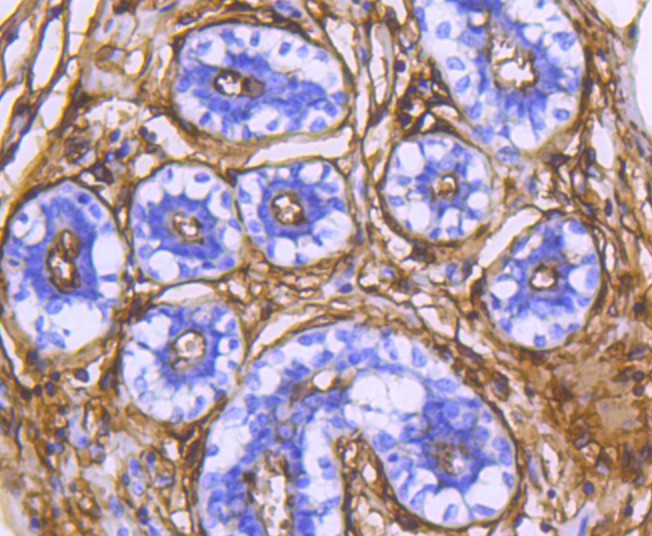 Immunohistochemical analysis of paraffin-embedded human breast tissue using anti-CD13 antibody. The section was pre-treated using heat mediated antigen retrieval with Tris-EDTA buffer (pH 8.0-8.4) for 20 minutes.The tissues were blocked in 5% BSA for 30 minutes at room temperature, washed with ddH2O and PBS, and then probed with the primary antibody (ET1611-61, 1/50) for 30 minutes at room temperature. The detection was performed using an HRP conjugated compact polymer system. DAB was used as the chromogen. Tissues were counterstained with hematoxylin and mounted with DPX.