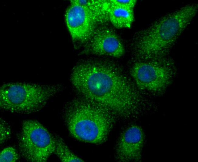 ICC staining of TMS1 in A549 cells (green). Formalin fixed cells were permeabilized with 0.1% Triton X-100 in TBS for 10 minutes at room temperature and blocked with 1% Blocker BSA for 15 minutes at room temperature. Cells were probed with the primary antibody (ET1611-62, 1/50) for 1 hour at room temperature, washed with PBS. Alexa Fluor®488 Goat anti-Rabbit IgG was used as the secondary antibody at 1/1,000 dilution. The nuclear counter stain is DAPI (blue).