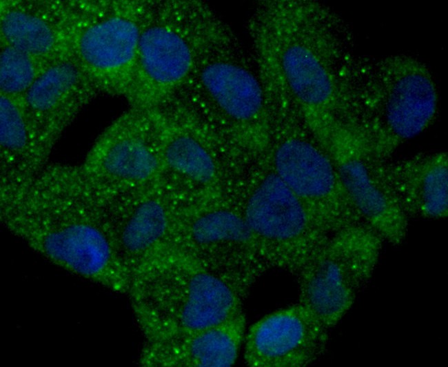 ICC staining of TMS1 in Hela cells (green). Formalin fixed cells were permeabilized with 0.1% Triton X-100 in TBS for 10 minutes at room temperature and blocked with 1% Blocker BSA for 15 minutes at room temperature. Cells were probed with the primary antibody (ET1611-62, 1/50) for 1 hour at room temperature, washed with PBS. Alexa Fluor®488 Goat anti-Rabbit IgG was used as the secondary antibody at 1/1,000 dilution. The nuclear counter stain is DAPI (blue).