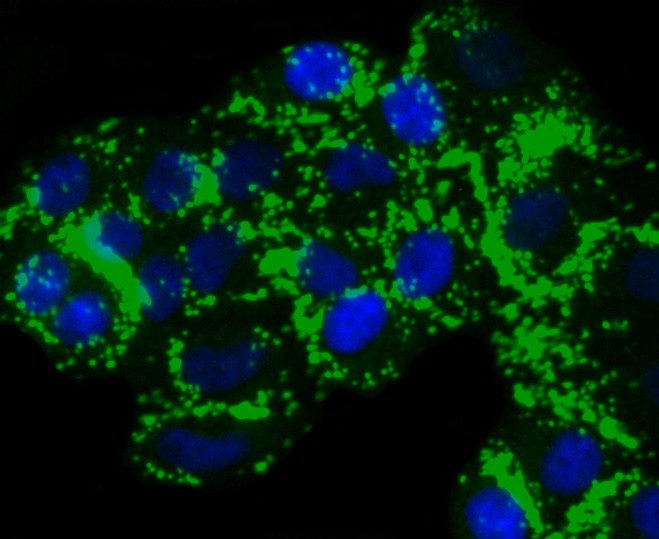 ICC staining of TMS1 in HepG2 cells (green). Formalin fixed cells were permeabilized with 0.1% Triton X-100 in TBS for 10 minutes at room temperature and blocked with 1% Blocker BSA for 15 minutes at room temperature. Cells were probed with the primary antibody (ET1611-62, 1/50) for 1 hour at room temperature, washed with PBS. Alexa Fluor®488 Goat anti-Rabbit IgG was used as the secondary antibody at 1/1,000 dilution. The nuclear counter stain is DAPI (blue).