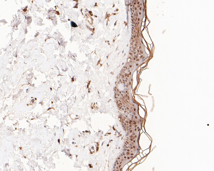 Immunohistochemical analysis of paraffin-embedded human skin tissue using anti-TMS1 antibody. The section was pre-treated using heat mediated antigen retrieval with sodium citrate buffer (pH 6.0) for 20 minutes. The tissues were blocked in 5% BSA for 30 minutes at room temperature, washed with ddH2O and PBS, and then probed with the primary antibody (ET1611-62, 1/50)  for 30 minutes at room temperature. The detection was performed using an HRP conjugated compact polymer system. DAB was used as the chromogen. Tissues were counterstained with hematoxylin and mounted with DPX.