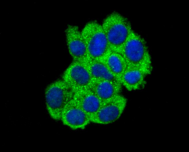 ICC staining of ABCF1 in HepG2 cells (green). Formalin fixed cells were permeabilized with 0.1% Triton X-100 in TBS for 10 minutes at room temperature and blocked with 10% negative goat serum for 15 minutes at room temperature. Cells were probed with the primary antibody (ET1611-63, 1/50) for 1 hour at room temperature, washed with PBS. Alexa Fluor®488 conjugate-Goat anti-Rabbit IgG was used as the secondary antibody at 1/1,000 dilution. The nuclear counter stain is DAPI (blue).
