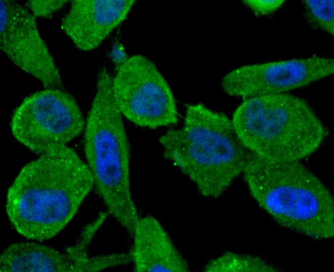 ICC staining of ABCF1 in PC-3M cells (green). Formalin fixed cells were permeabilized with 0.1% Triton X-100 in TBS for 10 minutes at room temperature and blocked with 10% negative goat serum for 15 minutes at room temperature. Cells were probed with the primary antibody (ET1611-63, 1/50) for 1 hour at room temperature, washed with PBS. Alexa Fluor®488 conjugate-Goat anti-Rabbit IgG was used as the secondary antibody at 1/1,000 dilution. The nuclear counter stain is DAPI (blue).