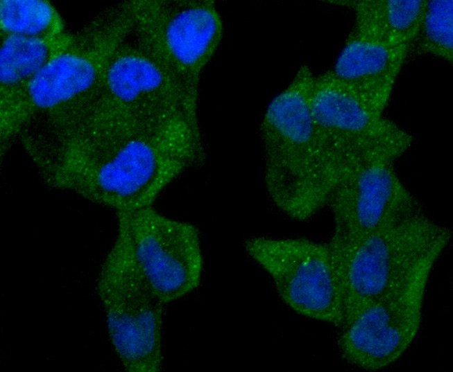 ICC staining of ABCF1 in Hela cells (green). Formalin fixed cells were permeabilized with 0.1% Triton X-100 in TBS for 10 minutes at room temperature and blocked with 10% negative goat serum for 15 minutes at room temperature. Cells were probed with the primary antibody (ET1611-63, 1/50) for 1 hour at room temperature, washed with PBS. Alexa Fluor®488 conjugate-Goat anti-Rabbit IgG was used as the secondary antibody at 1/1,000 dilution. The nuclear counter stain is DAPI (blue).