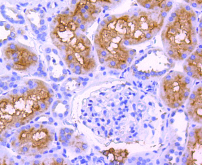 Immunohistochemical analysis of paraffin-embedded human kidney tissue using anti-ABCF1 antibody. The section was pre-treated using heat mediated antigen retrieval with Tris-EDTA buffer (pH 9.0) for 20 minutes.The tissues were blocked in 1% BSA for 30 minutes at room temperature, washed with ddH2O and PBS, and then probed with the primary antibody (ET1611-63, 1/50) for 30 minutes at room temperature. The detection was performed using an HRP conjugated compact polymer system. DAB was used as the chromogen. Tissues were counterstained with hematoxylin and mounted with DPX.