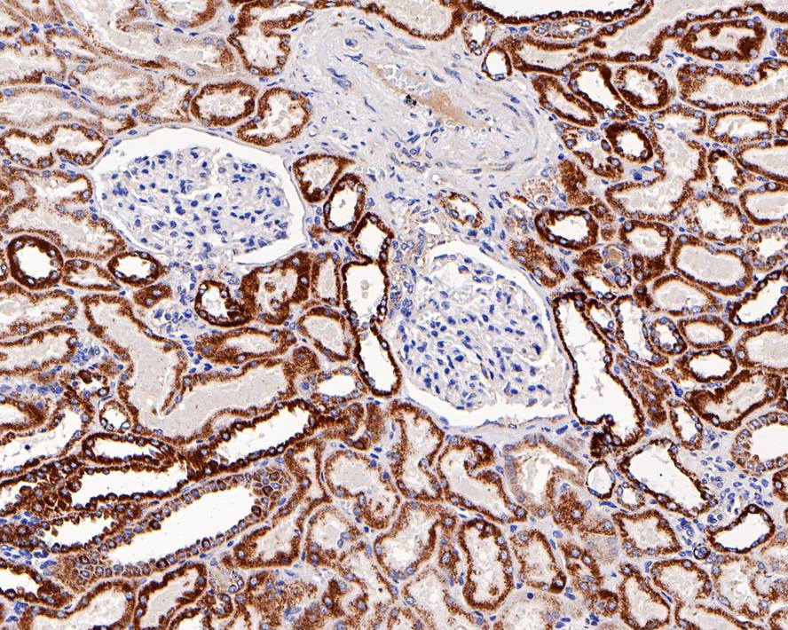 Immunohistochemical analysis of paraffin-embedded human kidney tissue with Rabbit anti-CPT2 antibody (ET1611-64) at 1/1,000 dilution.<br />
<br />
The section was pre-treated using heat mediated antigen retrieval with Tris-EDTA buffer (pH 9.0) for 20 minutes. The tissues were blocked in 1% BSA for 20 minutes at room temperature, washed with ddH2O and PBS, and then probed with the primary antibody (ET1611-64) at 1/1,000 dilution for 1 hour at room temperature. The detection was performed using an HRP conjugated compact polymer system. DAB was used as the chromogen. Tissues were counterstained with hematoxylin and mounted with DPX.