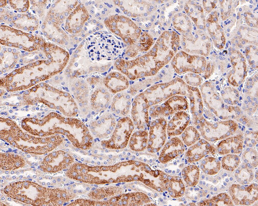 Immunohistochemical analysis of paraffin-embedded mouse kidney tissue with Rabbit anti-CPT2 antibody (ET1611-64) at 1/1,000 dilution.<br />
<br />
The section was pre-treated using heat mediated antigen retrieval with Tris-EDTA buffer (pH 9.0) for 20 minutes. The tissues were blocked in 1% BSA for 20 minutes at room temperature, washed with ddH2O and PBS, and then probed with the primary antibody (ET1611-64) at 1/1,000 dilution for 1 hour at room temperature. The detection was performed using an HRP conjugated compact polymer system. DAB was used as the chromogen. Tissues were counterstained with hematoxylin and mounted with DPX.