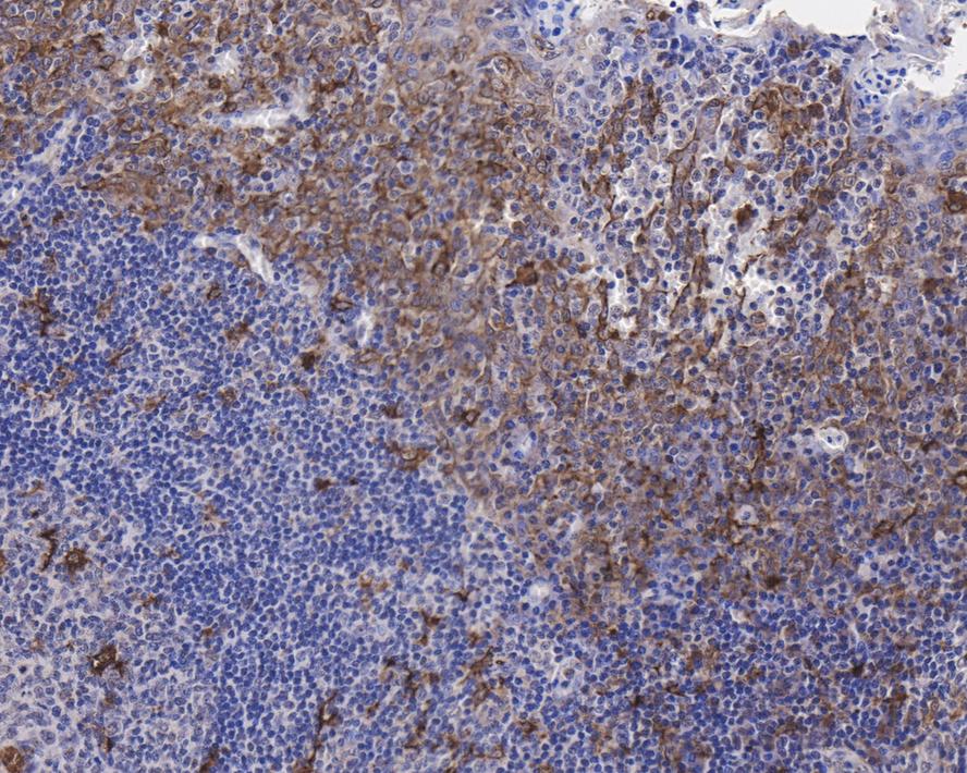 Immunohistochemical analysis of paraffin-embedded human tonsil tissue with Rabbit anti-CCR2 antibody (ET1611-65) at 1/500 dilution.<br />
<br />
The section was pre-treated using heat mediated antigen retrieval with Tris-EDTA buffer (pH 9.0) for 20 minutes. The tissues were blocked in 1% BSA for 20 minutes at room temperature, washed with ddH2O and PBS, and then probed with the primary antibody (ET1611-65) at 1/500 dilution for 1 hour at room temperature. The detection was performed using an HRP conjugated compact polymer system. DAB was used as the chromogen. Tissues were counterstained with hematoxylin and mounted with DPX.