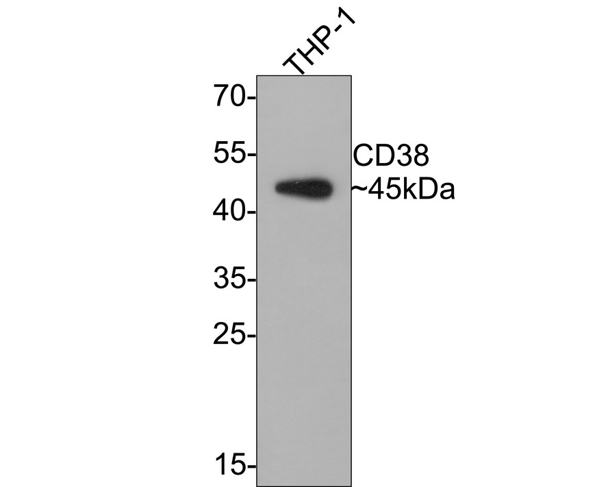 Western blot analysis of CD38 on THP-1 cell lysates with Rabbit anti-CD38 antibody (ET1611-66) at 1/1,000 dilution.<br />
<br />
Lysates/proteins at 10 µg/Lane.<br />
<br />
Predicted band size: 34 kDa<br />
Observed band size: 45 kDa<br />
<br />
Exposure time: 2 minutes;<br />
<br />
12% SDS-PAGE gel.<br />
<br />
Proteins were transferred to a PVDF membrane and blocked with 5% NFDM/TBST for 1 hour at room temperature. The primary antibody (ET1611-66) at 1/1,000 dilution was used in 5% NFDM/TBST at room temperature for 2 hours. Goat Anti-Rabbit IgG - HRP Secondary Antibody (HA1001) at 1:300,000 dilution was used for 1 hour at room temperature.