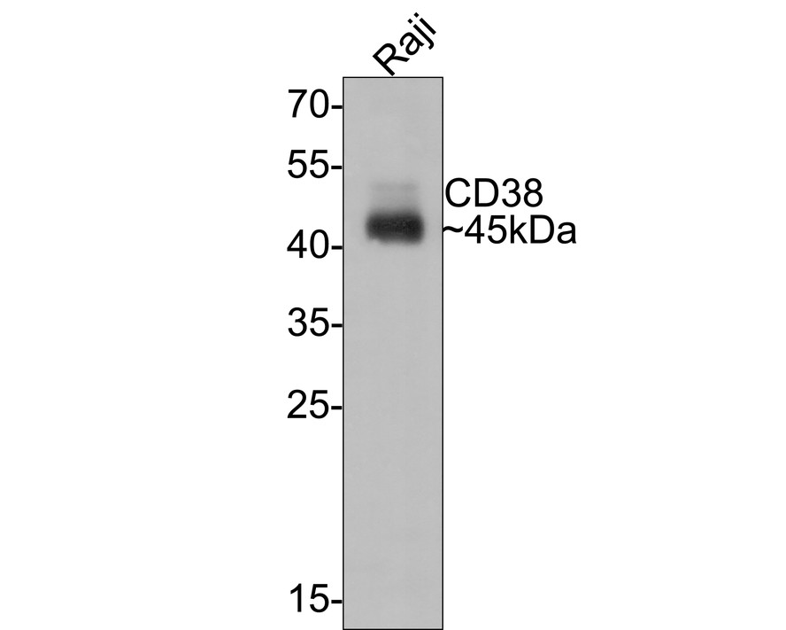 Western blot analysis of CD38 on Raji cell lysates with Rabbit anti-CD38 antibody (ET1611-66) at 1/1,000 dilution.<br />
<br />
Lysates/proteins at 10 µg/Lane.<br />
<br />
Predicted band size: 34 kDa<br />
Observed band size: 45 kDa<br />
<br />
Exposure time: 30 seconds;<br />
<br />
12% SDS-PAGE gel.<br />
<br />
Proteins were transferred to a PVDF membrane and blocked with 5% NFDM/TBST for 1 hour at room temperature. The primary antibody (ET1611-66) at 1/1,000 dilution was used in 5% NFDM/TBST at room temperature for 2 hours. Goat Anti-Rabbit IgG - HRP Secondary Antibody (HA1001) at 1:300,000 dilution was used for 1 hour at room temperature.