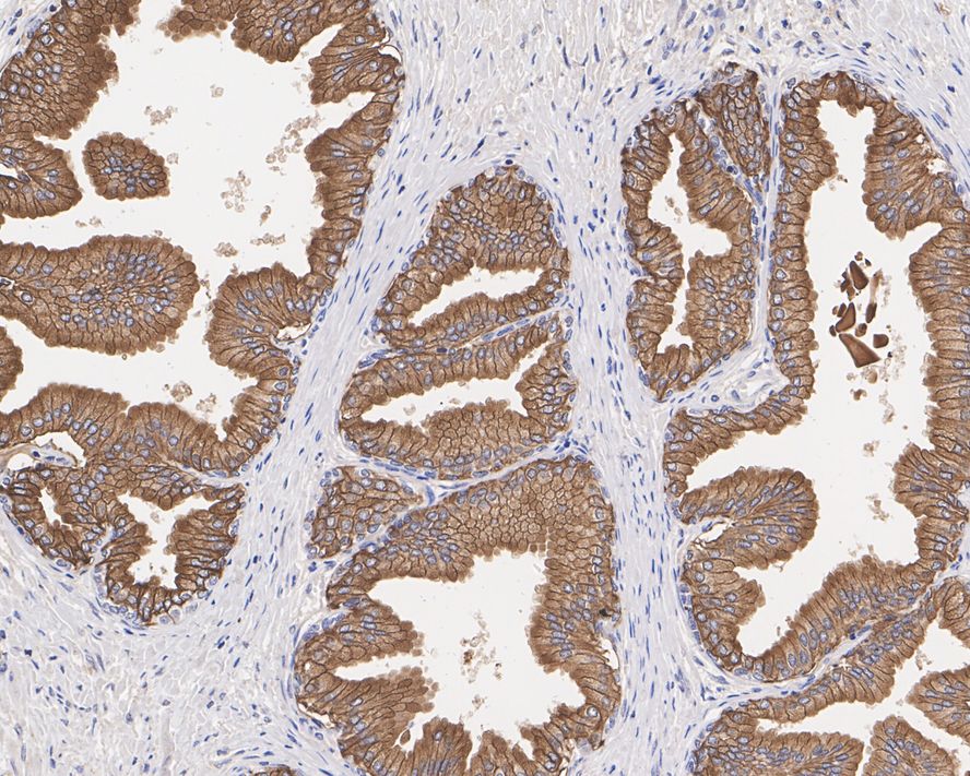 Immunohistochemical analysis of paraffin-embedded human spleen tissue using anti-CD38 antibody. The section was pre-treated using heat mediated antigen retrieval with Tris-EDTA buffer (pH 8.0-8.4) for 20 minutes.The tissues were blocked in 5% BSA for 30 minutes at room temperature, washed with ddH2O and PBS, and then probed with the primary antibody (ET1611-66, 1/50) for 30 minutes at room temperature. The detection was performed using an HRP conjugated compact polymer system. DAB was used as the chromogen. Tissues were counterstained with hematoxylin and mounted with DPX.