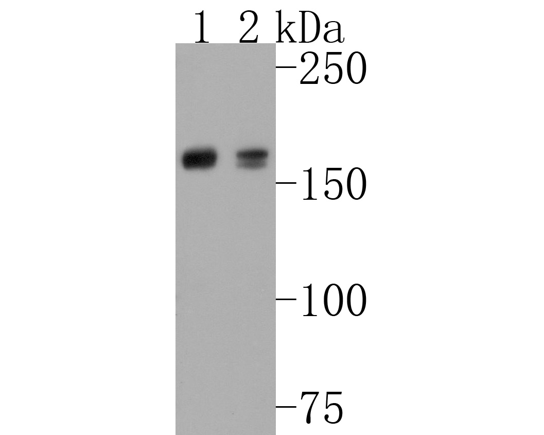 Western blot analysis of FANCD2 on different lysates. Proteins were transferred to a PVDF membrane and blocked with 5% BSA in PBS for 1 hour at room temperature. The primary antibody (ET1611-67, 1/500) was used in 5% BSA at room temperature for 2 hours. Goat Anti-Rabbit IgG - HRP Secondary Antibody (HA1001) at 1:200,000 dilution was used for 1 hour at room temperature.<br />
Positive control: <br />
Lane 1: Daudi cell lysate<br />
Lane 2: K562 cell lysate