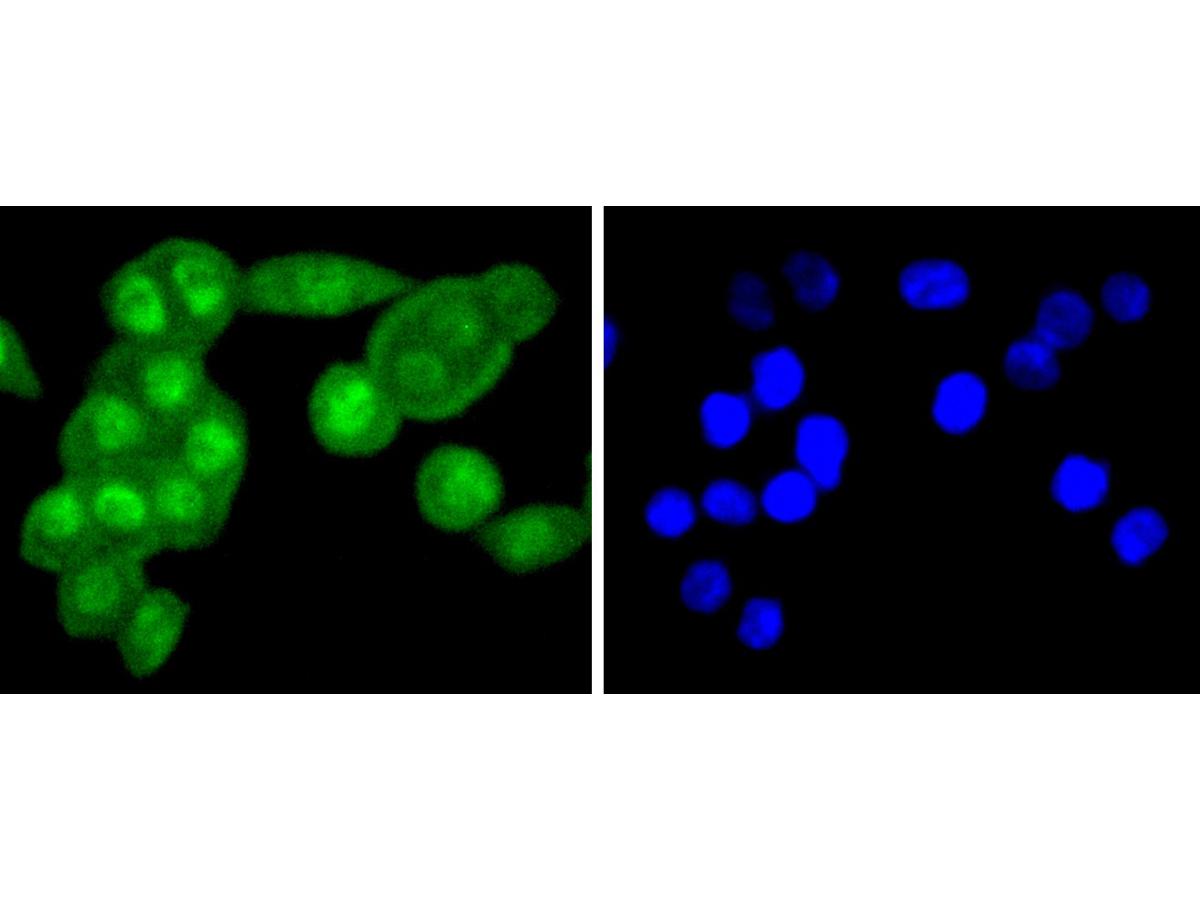 ICC staining of FANCD2 in SW480 cells (green). Formalin fixed cells were permeabilized with 0.1% Triton X-100 in TBS for 10 minutes at room temperature and blocked with 1% Blocker BSA for 15 minutes at room temperature. Cells were probed with the primary antibody (ET1611-67, 1/50) for 1 hour at room temperature, washed with PBS. Alexa Fluor®488 Goat anti-Rabbit IgG was used as the secondary antibody at 1/1,000 dilution. The nuclear counter stain is DAPI (blue).