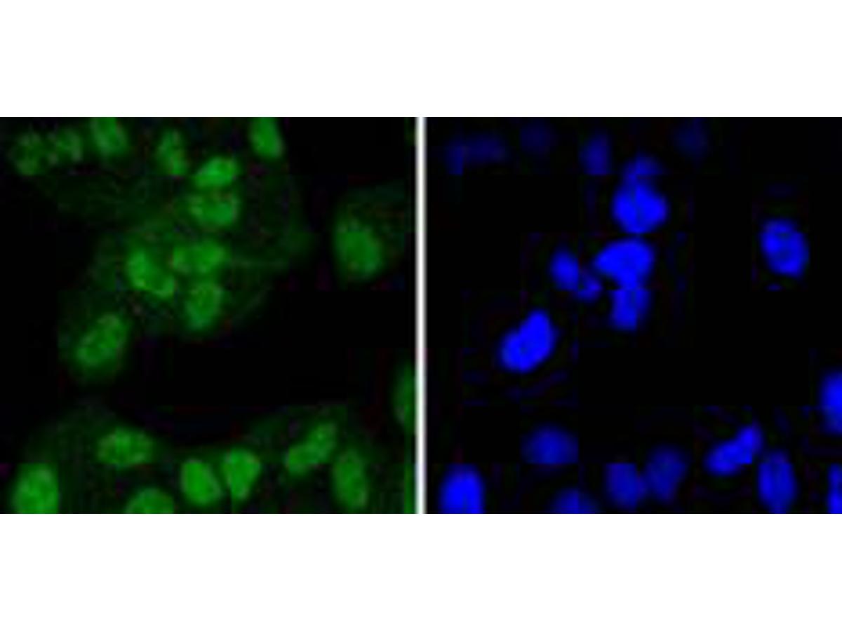 ICC staining of FANCD2 in Hela cells (green). Formalin fixed cells were permeabilized with 0.1% Triton X-100 in TBS for 10 minutes at room temperature and blocked with 1% Blocker BSA for 15 minutes at room temperature. Cells were probed with the primary antibody (ET1611-67, 1/50) for 1 hour at room temperature, washed with PBS. Alexa Fluor®488 Goat anti-Rabbit IgG was used as the secondary antibody at 1/1,000 dilution. The nuclear counter stain is DAPI (blue).